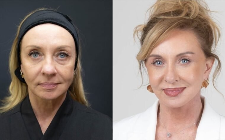“Bem-vindos ao luxo”: facelift reforça imagem de corretora de alto padrão