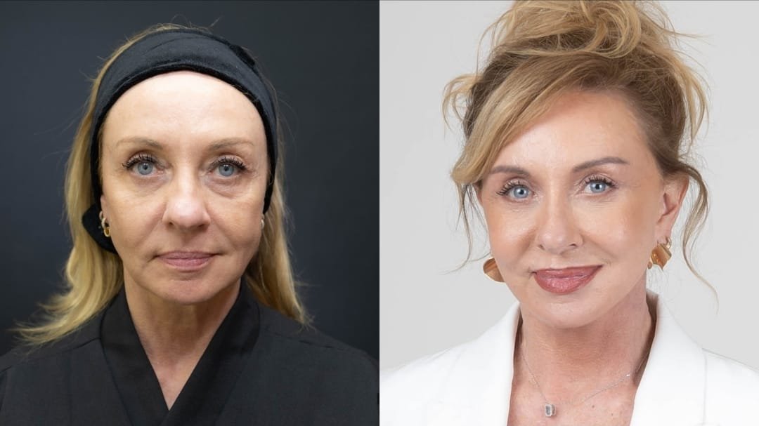 “Bem-vindos ao luxo”: facelift reforça imagem de corretora de alto padrão
