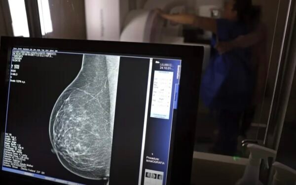 Plano de saúde terá que cobrir mamografia digital para todas as idades