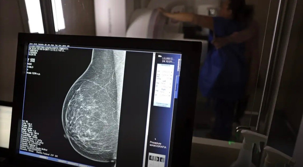 Plano de saúde terá que cobrir mamografia digital para todas as idades